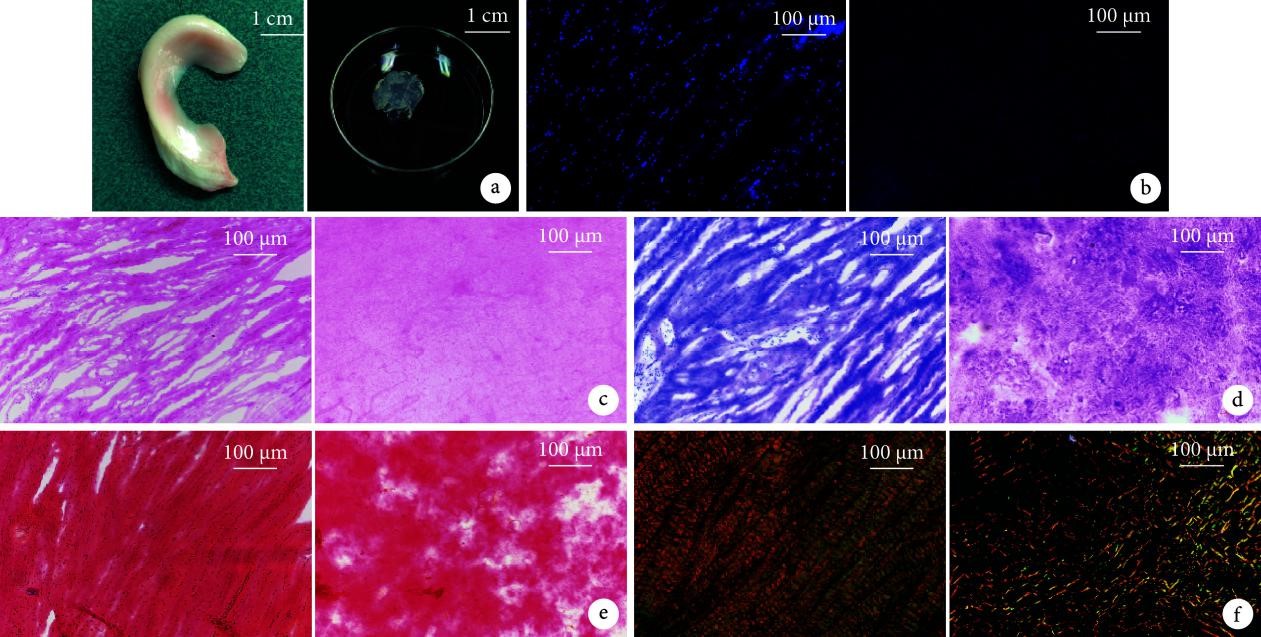 CJPRS|首都醫科大學附屬北京積水潭醫院矯形骨科陳明學醫生基于低溫沉積 3D 打印技術構建新型組織工程半月板支架的研究