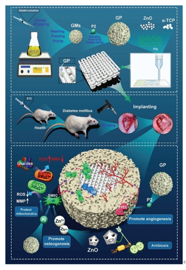 高活性肽-金屬離子-骨水泥三重整合3D打印復合支架促進糖尿病骨缺損的骨血管再生修復
